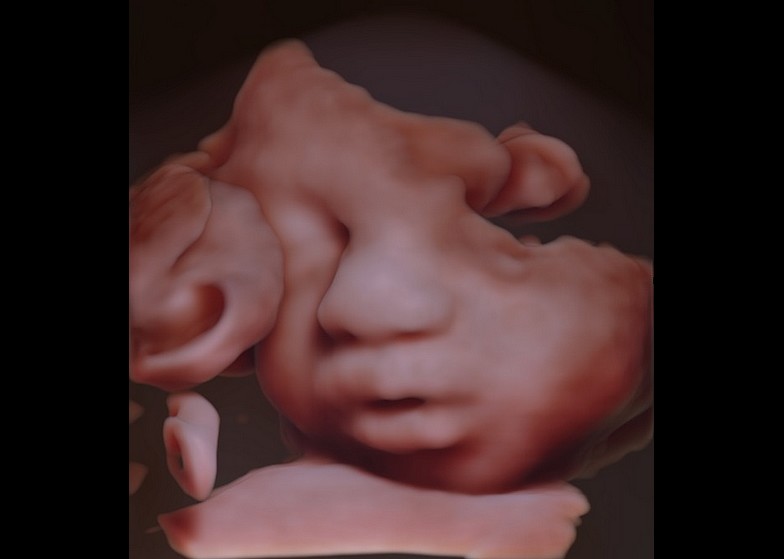 Echographie 1er trimestre Image
